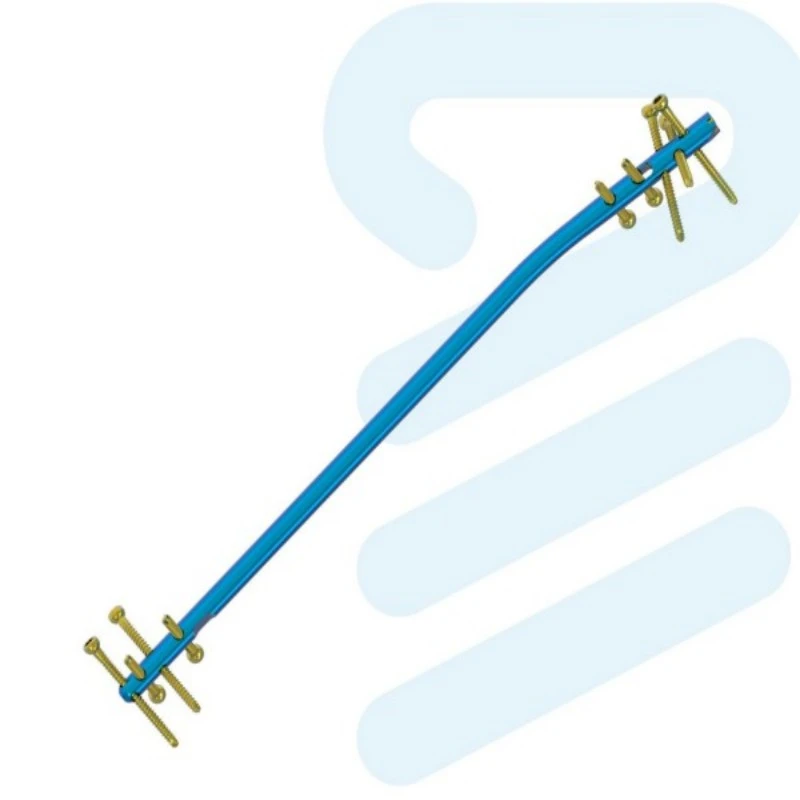 Intramedullary Interlocking Nail Tibia
